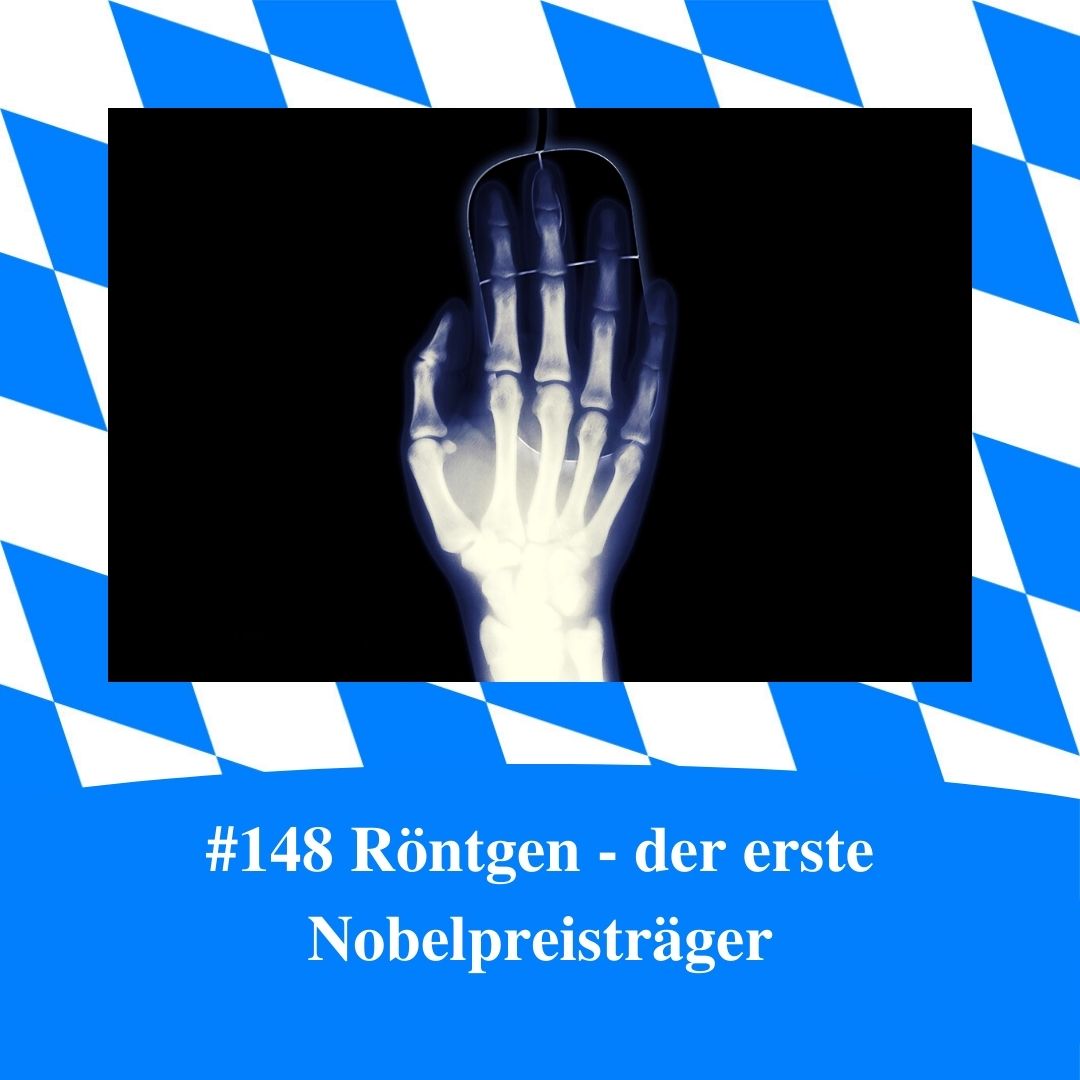 Bild für Folge Nummer 148 des bayerischen Podcasts Bayern Absolut. Es ist das Röntgenbild einer Hand mitsamt Computermaus zu sehen. Die Folge trägt den Titel: “Röntgen - der erste Nobelpreisträger”. Das Bild ist umrahmt von weiß-blauen bayerischen Rauten.
